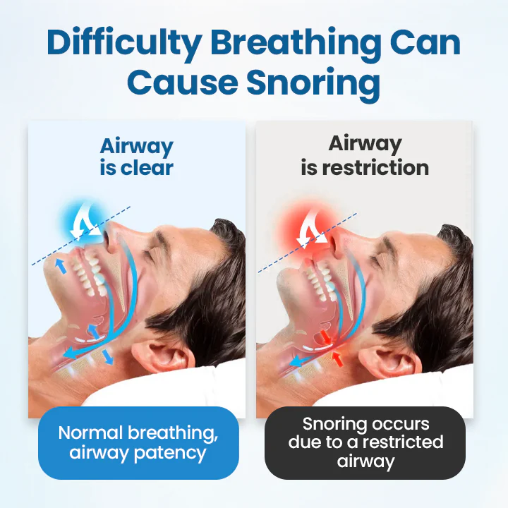 LOVILDS® SnoreLess Nasal Breather