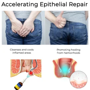 Cvreoz® Herbal Hemorrhoid Treatment Anal Spray Pro image Cvreoz® Herbal Hemorrhoid Treatment Anal Spray Pro