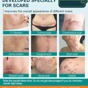 Advanced Scar Spray For All Types of Scars image Advanced Scar Spray For All Types of Scars