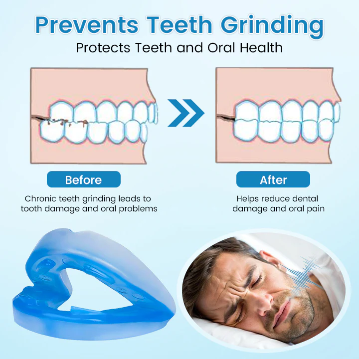 QIAWI™ DreamGuard: Anti-Snoring & Teeth Grinding Mouthpiece image QIAWI™ DreamGuard: Anti-Snoring & Teeth Grinding Mouthpiece