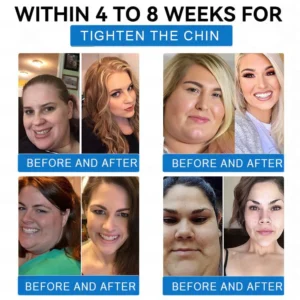 Grunsify® SMGT-GLP-1 Tirzepatide & Collagen Nano Microneedle Weight Loss Patch