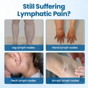 Timilk® Lymphora Swelling Relief Roll-On image Timilk® Lymphora Swelling Relief Roll-On