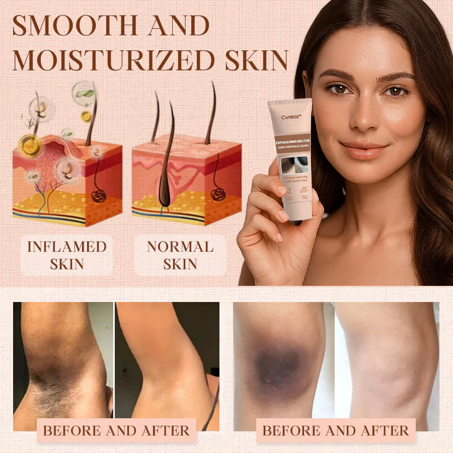 Cvreoz® Purifying Exfoliating Gel image Cvreoz® Purifying Exfoliating Gel