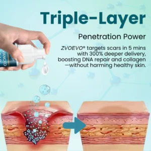 Zvoevo® Advanced Scar Gel