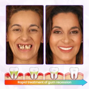 Oveallgo® BeeRenew Advanced Gum Healing Toothpaste image Oveallgo® BeeRenew Advanced Gum Healing Toothpaste