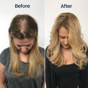 LAOZIK™ Maximum Strength 5% Minoxidil Fast-Action Hair Growth Serum image LAOZIK™ Maximum Strength 5% Minoxidil Fast-Action Hair Growth Serum