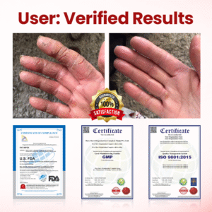 VitaGluco Diabetic Care Cream image VitaGluco Diabetic Care Cream