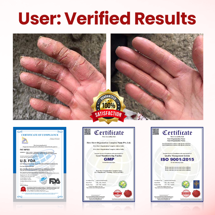 VitaGluco Diabetic Care Cream image VitaGluco Diabetic Care Cream