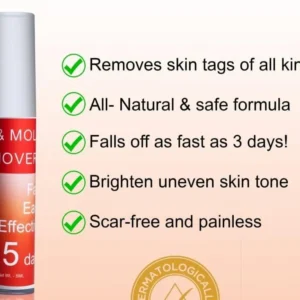 LOVILDS™ Tags & Moles Remover