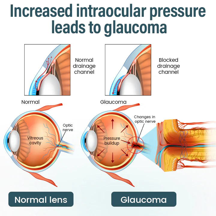 LOVILDS® OptiFusion Nano Eye Drops Serum image LOVILDS® OptiFusion Nano Eye Drops Serum