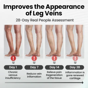 Czticle® Leg Vein Magnet Ankle Bracelet image Czticle® Leg Vein Magnet Ankle Bracelet