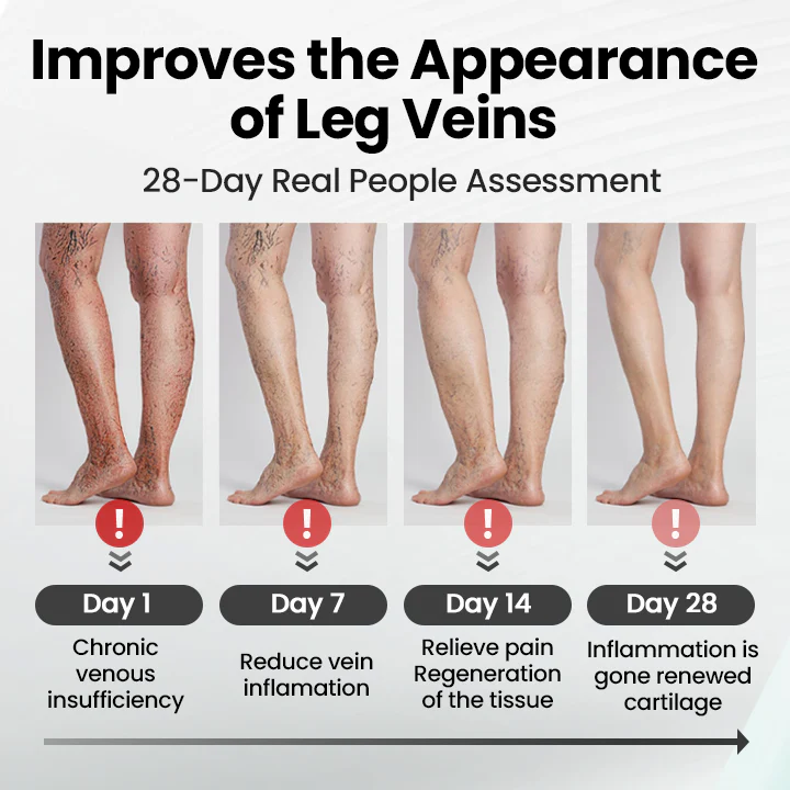 Czticle® Leg Vein Magnet Ankle Bracelet image Czticle® Leg Vein Magnet Ankle Bracelet