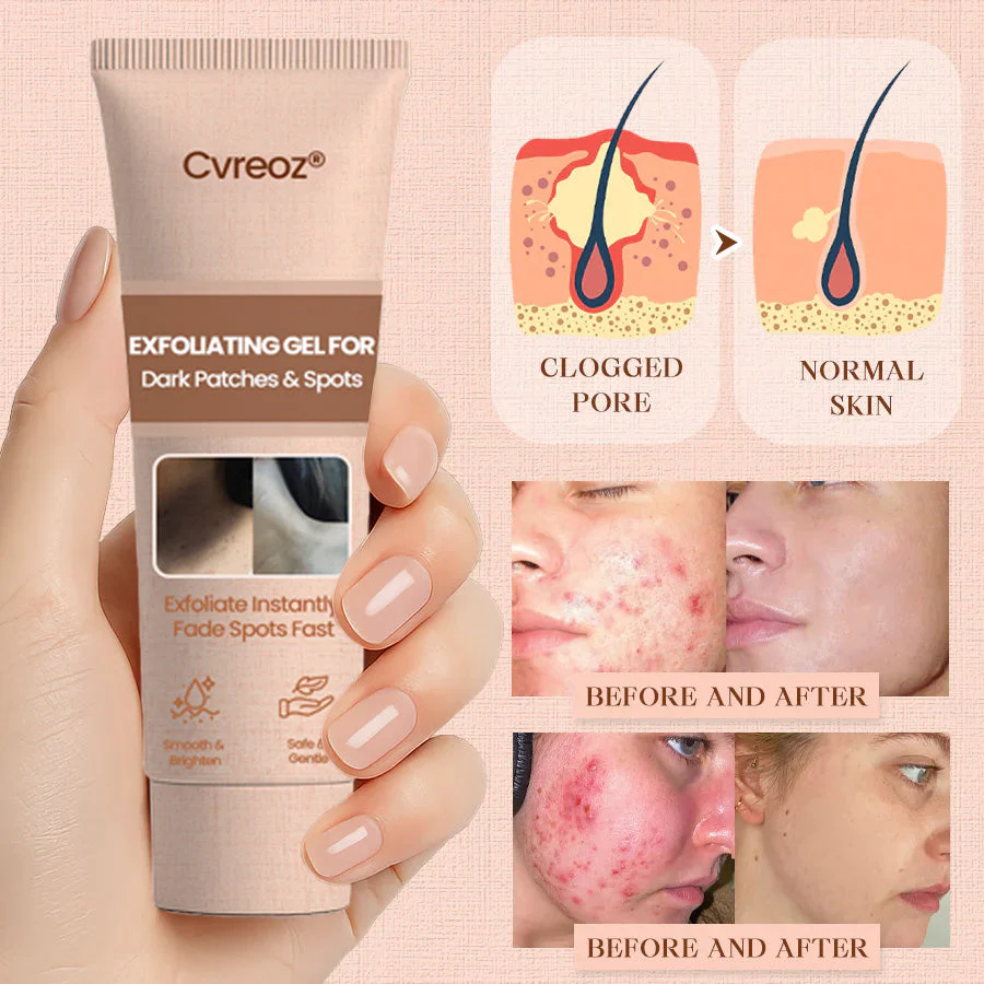 Cvreoz® Purifying Exfoliating Gel image Cvreoz® Purifying Exfoliating Gel