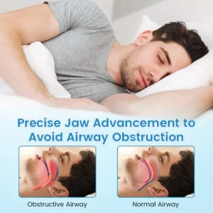 QIAWI™ DreamGuard: Anti-Snoring & Teeth Grinding Mouthpiece image QIAWI™ DreamGuard: Anti-Snoring & Teeth Grinding Mouthpiece
