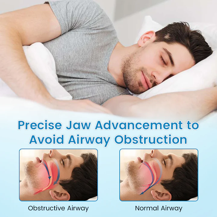 QIAWI™ DreamGuard: Anti-Snoring & Teeth Grinding Mouthpiece image QIAWI™ DreamGuard: Anti-Snoring & Teeth Grinding Mouthpiece