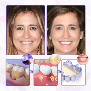 Oveallgo® BeeRenew Advanced Gum Healing Toothpaste image Oveallgo® BeeRenew Advanced Gum Healing Toothpaste