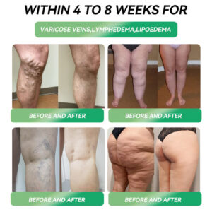 Croaie® Telportide Oral Solution image Croaie® Telportide Oral Solution