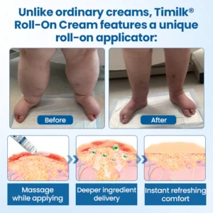 Timilk® Lymphora Swelling Relief Roll-On image Timilk® Lymphora Swelling Relief Roll-On