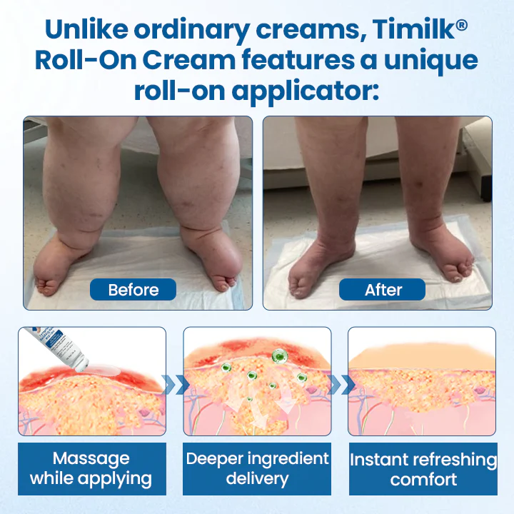 Timilk® Lymphora Swelling Relief Roll-On image Timilk® Lymphora Swelling Relief Roll-On