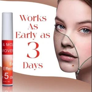 LOVILDS™ Tags & Moles Remover