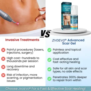 Zvoevo® Advanced Scar Gel