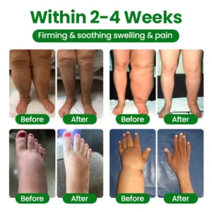 Timilk® VenoLift Leg Relief Spray