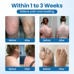 Timilk® BPC-157 Joint Repair Cream