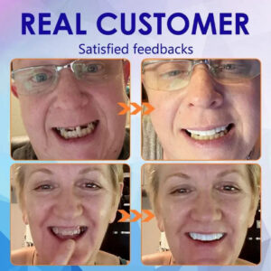 NESLEMY-Advanced Customized Full Denture Set image NESLEMY-Advanced Customized Full Denture Set