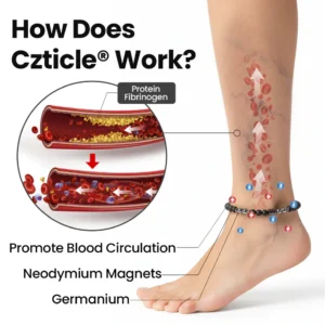 Czticle® Leg Vein Magnet Ankle Bracelet image Czticle® Leg Vein Magnet Ankle Bracelet