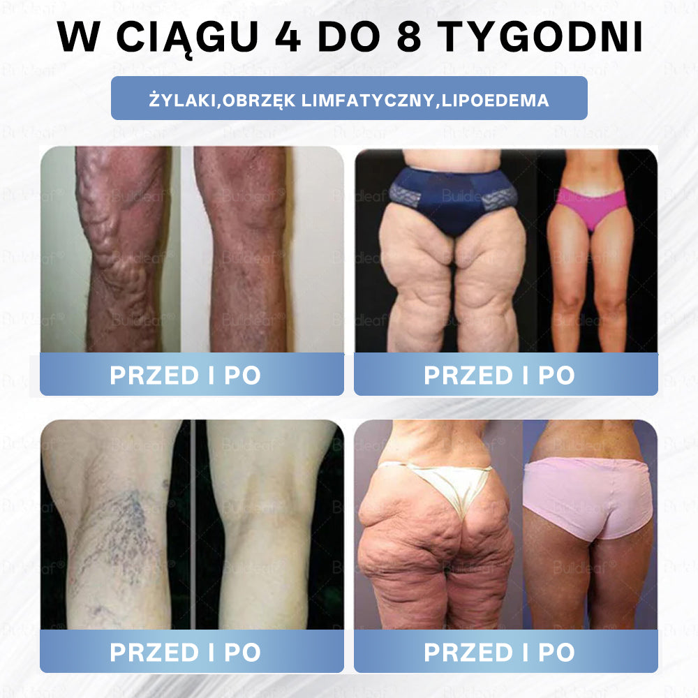 Croaie® Nano Microneedle Patch with SMGT-GLP-1 image Croaie® Nano Microneedle Patch with SMGT-GLP-1