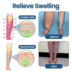 KUBOZN® Roll-On Cream image KUBOZN® Roll-On Cream