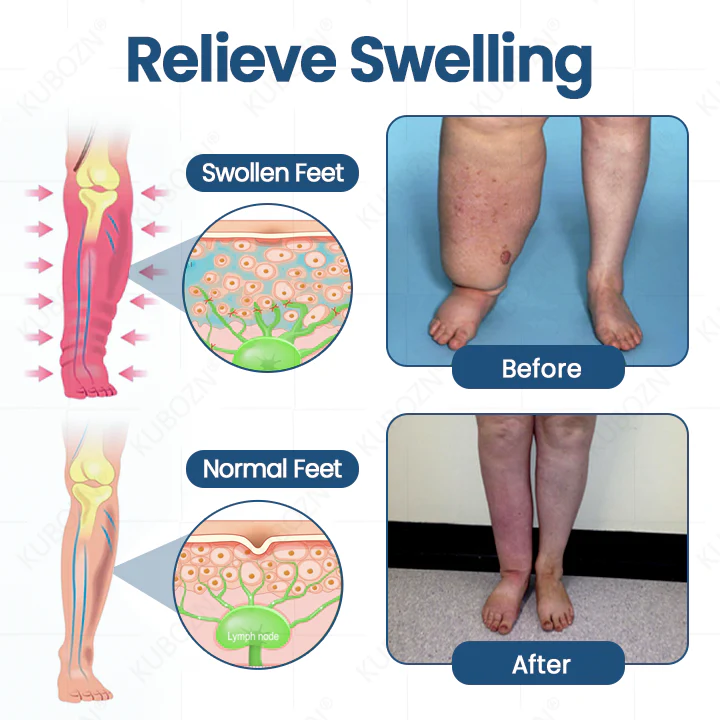 KUBOZN® Roll-On Cream image KUBOZN® Roll-On Cream