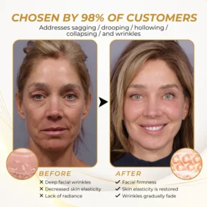 LOVILDS® FirmFlora Skin Lifting Cream image LOVILDS® FirmFlora Skin Lifting Cream