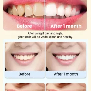 Probiotic Rapid Whitening Toothpaste