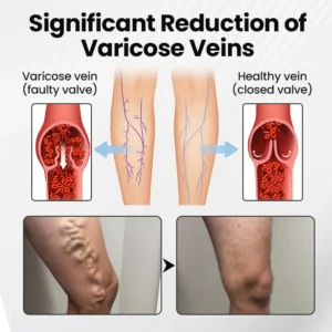 Czticle® Leg Vein Magnet Ankle Bracelet image Czticle® Leg Vein Magnet Ankle Bracelet