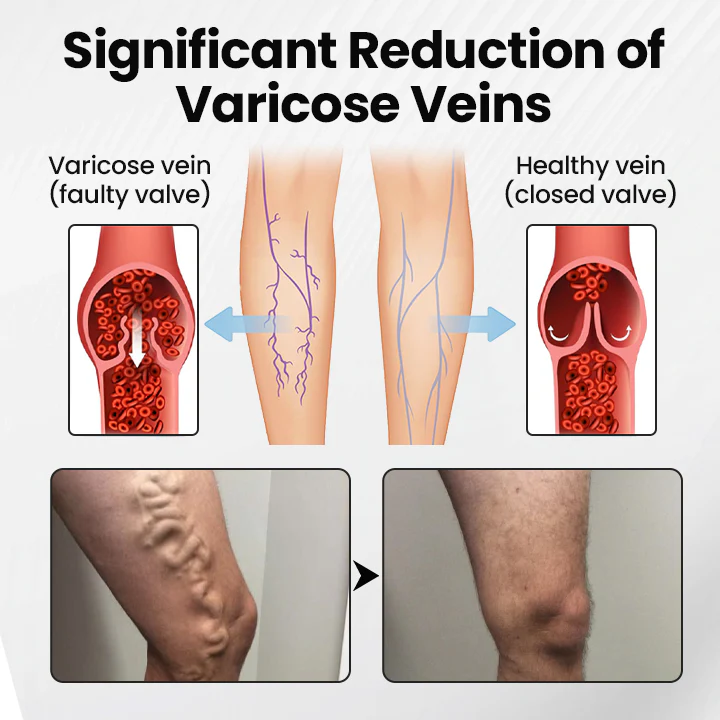 Czticle® Leg Vein Magnet Ankle Bracelet image Czticle® Leg Vein Magnet Ankle Bracelet