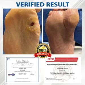 CVREOZ® Diabetes Foot Guard Fast Recovery Spray image CVREOZ® Diabetes Foot Guard Fast Recovery Spray