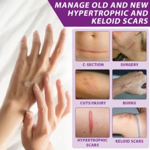 ATTDX® NanoHeal Advanced Face & Body Scar Gel