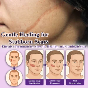 ATTDX® NanoHeal Advanced Face & Body Scar Gel