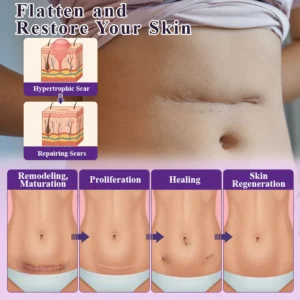 ATTDX® NanoHeal Advanced Face & Body Scar Gel