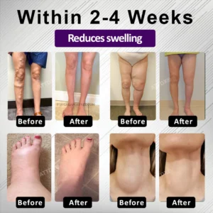 ATTDX® Edemora Overnight Balance Spray image ATTDX® Edemora Overnight Balance Spray