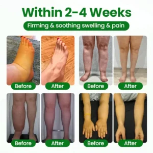 Cougex® VenoLift Leg Relief Spray