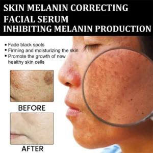 AQA™ Melanin Correcting Facial Serum