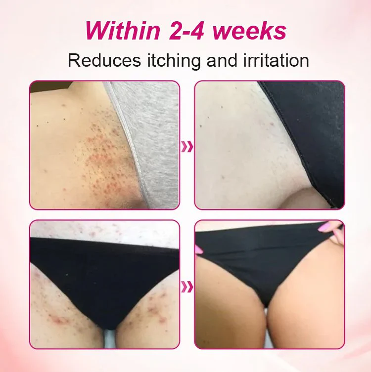 Alisanda Feminine Care Gel image Alisanda Feminine Care Gel