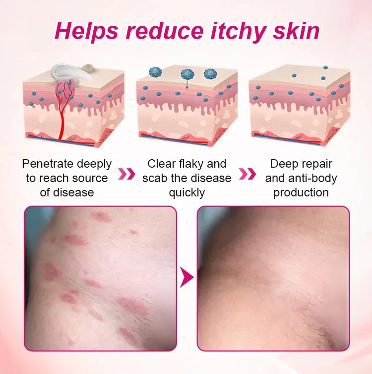 Alisanda Feminine Care Gel image Alisanda Feminine Care Gel