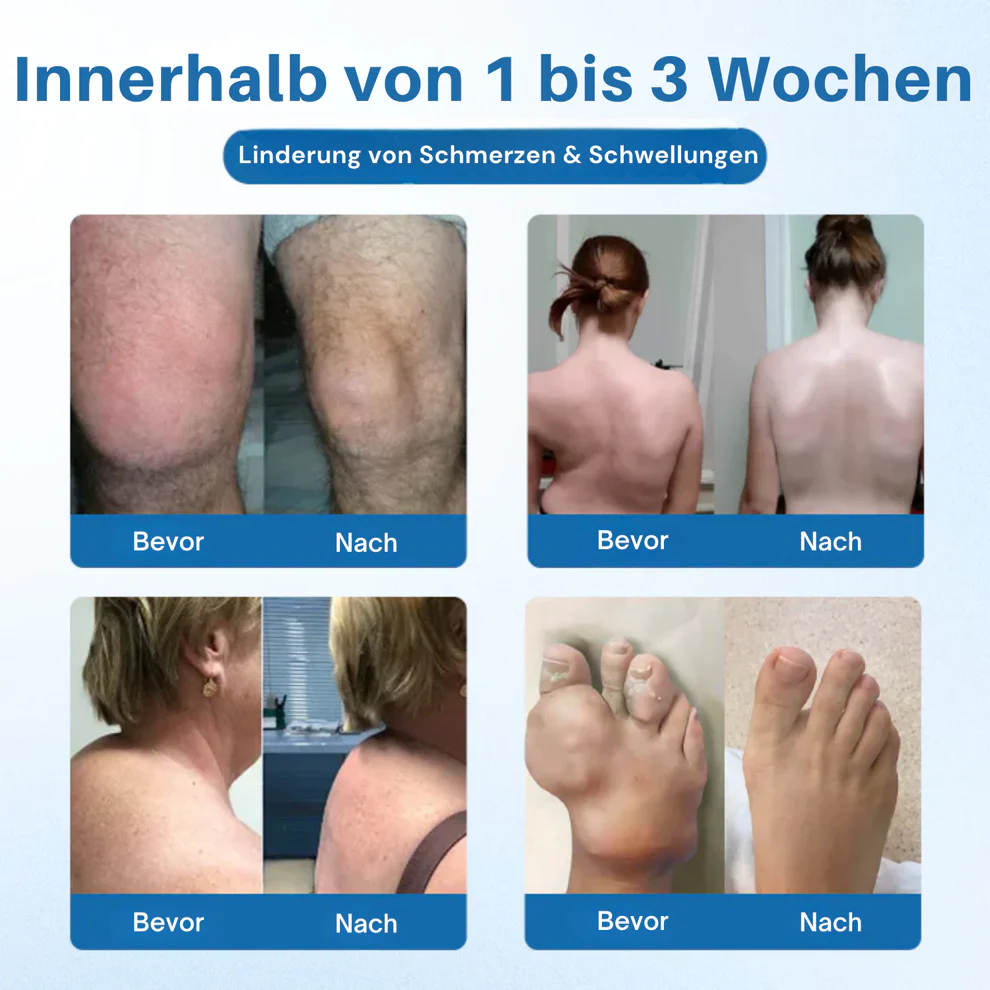 NovaRX® BPC-157 Joint Repair Cream