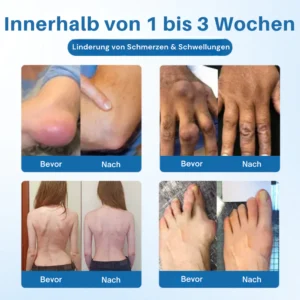 NovaRX® BPC-157 Joint Repair Cream