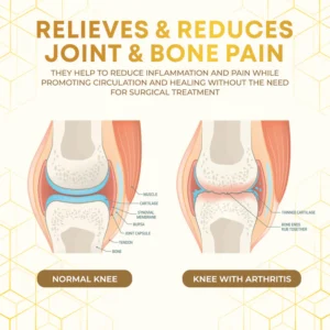 Seurico™ Bee Venom Joint Therapy Pain Relief Gel 12 Seurico™ Bee Venom Joint Therapy Pain Relief Gel