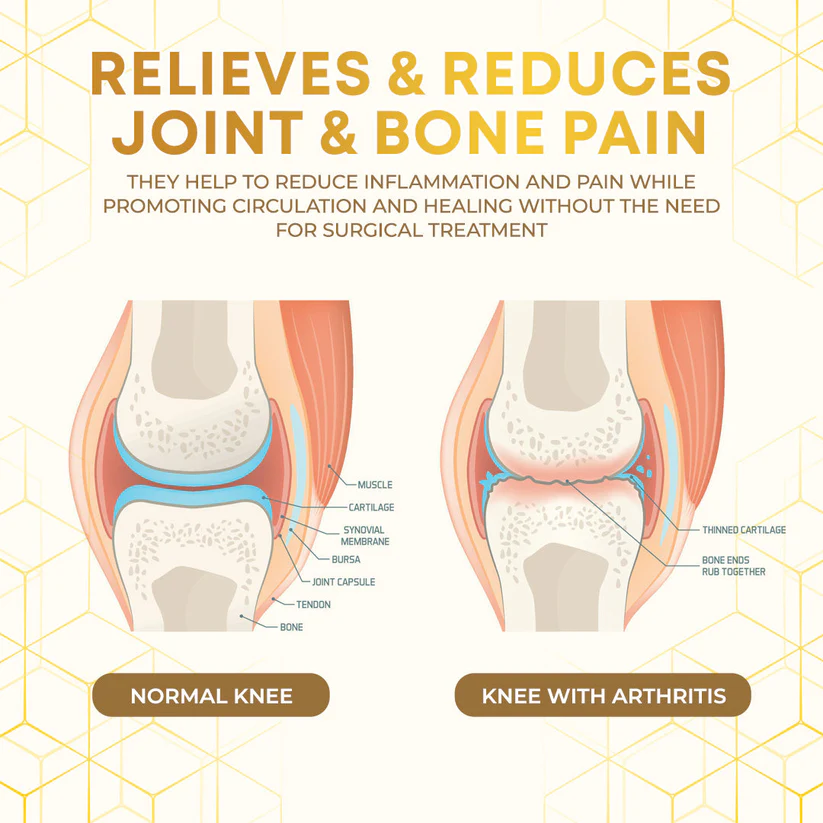 Seurico™ Bee Venom Joint Therapy Pain Relief Gel 3 Seurico™ Bee Venom Joint Therapy Pain Relief Gel