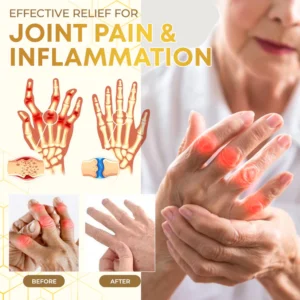 Seurico™ Bee Venom Joint Therapy Pain Relief Gel 15 Seurico™ Bee Venom Joint Therapy Pain Relief Gel